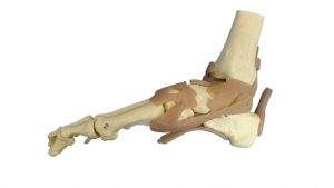 足底のアーチの骨の図